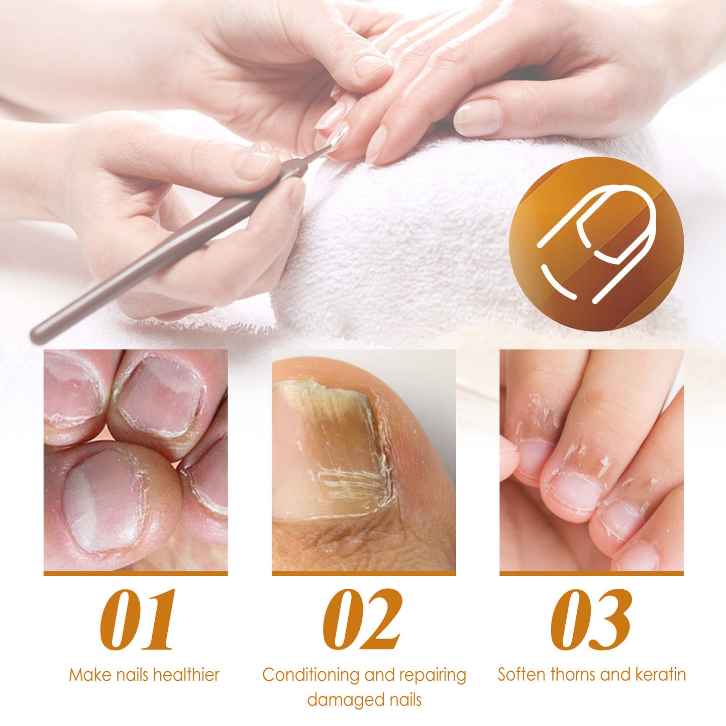Repair Gray Nail Soft Nail Rotten Nail Dead Skin Moisturizing Care Solution