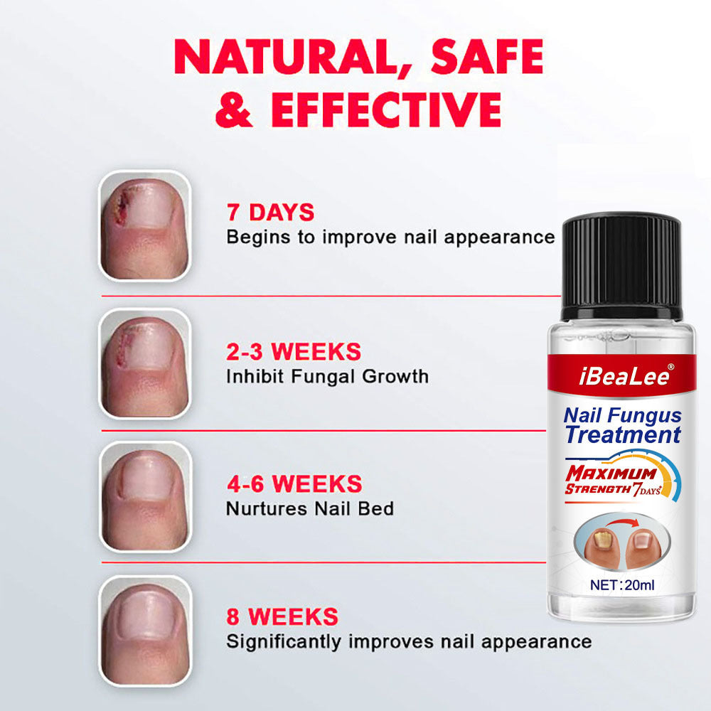 Thickening Of Special Bacteriostatic Liquid For Onychomycosis