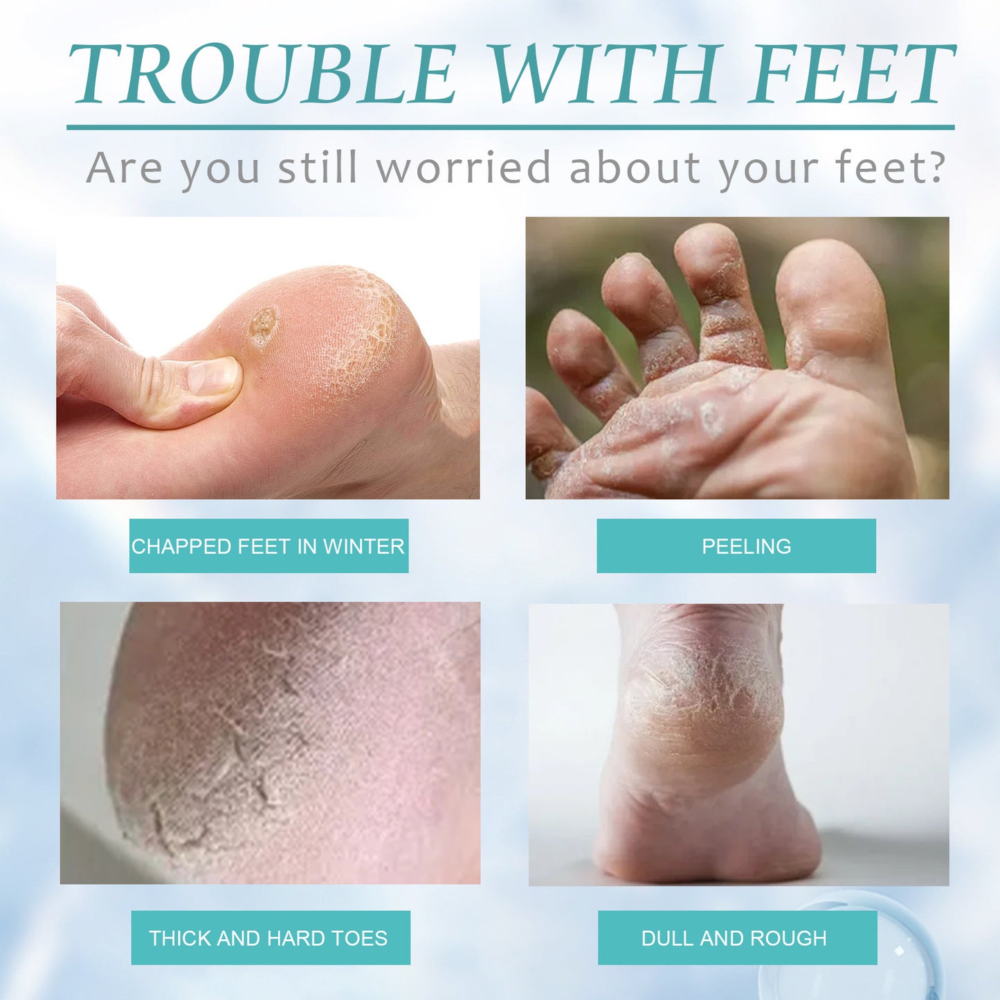 Calluses Repair Spray Foot Heel Anti-chapping Cleaning Cutin