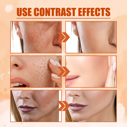 Skin Moisturizing And Fading Spray
